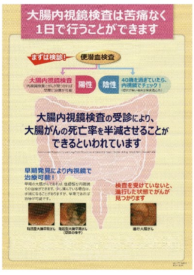 大腸内視鏡検査（大腸カメラ）