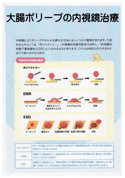 大腸内視鏡