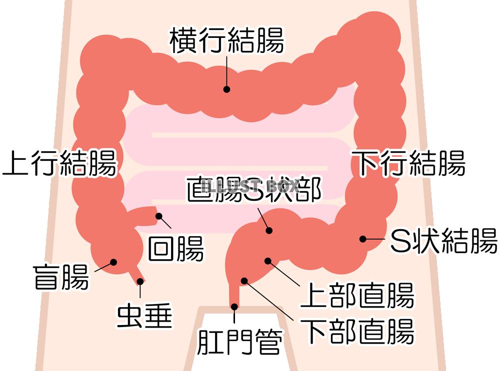 大腸 が ん お腹 の 張り